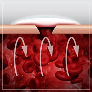 blocks further bleeding